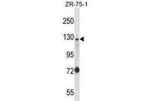 UBE4A Antibody (Center) western blot analysis in ZR-75-1 cell line lysates (35 µg/lane). (UBE4A antibody  (Middle Region))