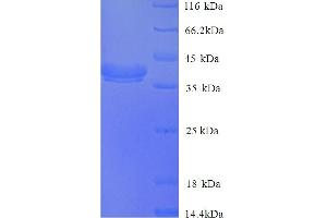SDS-PAGE (SDS) image for PLY1 (AA 22-374) protein (His tag) (ABIN5714054) (PLY1 (AA 22-374) protein (His tag))