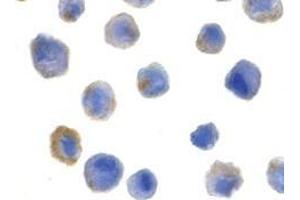 Immunocytochemistry of FLIP in HeLa cells with AP30341PU-N FLIP antibody at 5 μg/ml. (FLIP antibody  (N-Term))