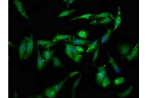 Immunofluorescence staining of Hela cells with ABIN7152118 at 1:133, counter-stained with DAPI. (GSPT1 antibody  (AA 6-142))
