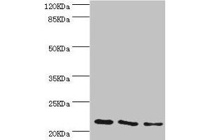 Western blot All lanes: TAGLN2 antibody at 4. (TAGLN2 antibody  (AA 1-199))