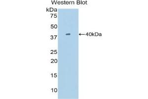 Detection of Recombinant SIGIRR, Mouse using Polyclonal Antibody to Single Ig IL1 Related Receptor (SIGIRR) (SIGIRR antibody  (AA 1-117))