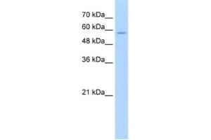 Western Blotting (WB) image for anti-Solute Carrier Family 22 (Organic Cation Transporter), Member 16 (SLC22A16) antibody (ABIN2462772) (SLC22A16 antibody)