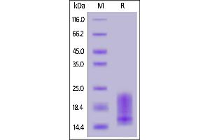 Biotinylated Human BAFFR, His,Avitag on  under reducing (R) condition.