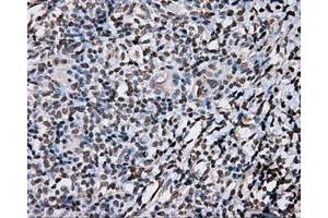 Immunohistochemical staining of paraffin-embedded liver tissue using anti-DAPK2 mouse monoclonal antibody.