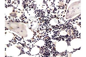 Formalin-fixed and paraffin embedded rat articular cartilage labeled with Anti-MMP-13 Polyclonal Antibody (ABIN670341), Unconjugated at 1:200, followed by conjugation to the secondary antibody and DAB staining (MMP13 antibody  (AA 201-300))