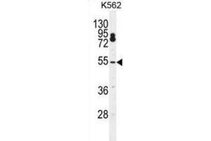 Western Blotting (WB) image for anti-Cleavage and Polyadenylation Specific Factor 7, 59kDa (CPSF7) antibody (ABIN2996552)