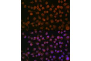 Immunofluorescence analysis of HeLa cells using Emerin/EMD Rabbit mAb (ABIN7266933) at dilution of 1:100 (40x lens). (Emerin antibody)