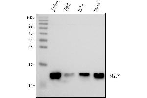 Western blot analysis of MIF using anti-MIF antibody (ABIN3043878).