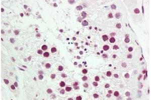 Human Testis: Formalin-Fixed, Paraffin-Embedded (FFPE) (NR2F2 antibody  (AA 1-30))