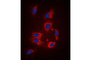 Immunofluorescent analysis of PAR1 staining in HeLa cells. (PAR1 antibody  (N-Term))