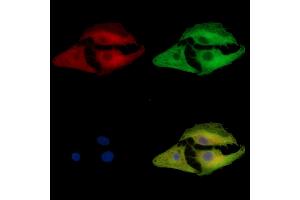 anti-FCH Domain Only 1 (FCHO1) antibody