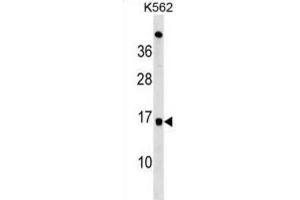 Western Blotting (WB) image for anti-Ubiquitin-Conjugating Enzyme E2D 4 (UBE2D4) antibody (ABIN3000670) (UBE2D4 antibody)