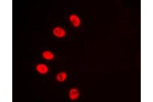 Immunofluorescent analysis of NR2F6 staining in HepG2 cells. (NR2F6 antibody  (N-Term))