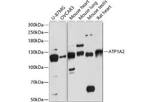 Western blot analysis of extracts of various cell lines, using  antibody (ABIN6129199, ABIN6137302, ABIN6137303 and ABIN6217930) at 1:3000 dilution.