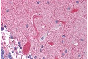 Human Brain, Cerebellum (formalin-fixed, paraffin-embedded) stained with PEG3 antibody ABIN214135 at 5 ug/ml followed by biotinylated goat anti-rabbit IgG secondary antibody ABIN481713, alkaline phosphatase-streptavidin and chromogen. (PEG3 antibody  (C-Term))
