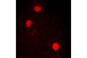 Immunofluorescent analysis of SOX2 staining in MCF7 cells. (SOX2 antibody)