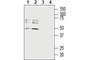 Western blot analysis of rat (lanes 1 and 3) and mouse (lanes 2 and 4) brain lysates: - 1,2. (SLC16A3 antibody  (C-Term, Intracellular))