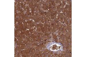 Immunohistochemical staining of human liver with NUDT16L1 polyclonal antibody  shows strong cytoplasmic positivity in hepatocytes at 1:200-1:500 dilution. (NUDT16L1 antibody)