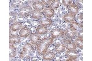 Immunohistochemistry (IHC) image for anti-Mitochondrial Carrier 2 (MTCH2) (N-Term) antibody (ABIN1031463)
