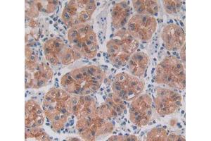 Used in DAB staining on fromalin fixed paraffin- embedded Kidney tissue (ROR2 antibody  (AA 683-934))