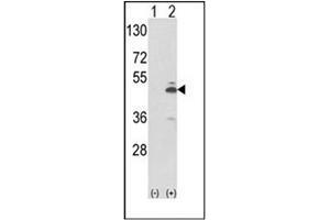 Western blot analysis of PKM2 (arrow) using PKM2 Antibody (N-term) Cat. (PKM2 antibody  (N-Term))