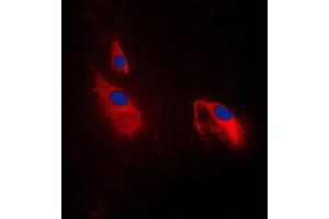 Immunofluorescent analysis of PFKP staining in NIH3T3 cells. (PFKP antibody  (Center))