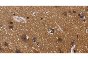 Immunohistochemistry of paraffin-embedded Human brain using FGFR1OP Polyclonal Antibody at dilution of 1:40 (FGFR1OP antibody)