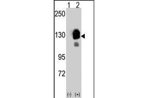 Western blot analysis of CDH8 (arrow) using rabbit CDH8 polyclonal antibody .