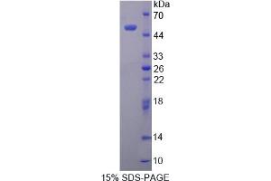 Image no. 1 for Laminin, gamma 3 (LAMC3) (AA 901-1100) protein (His tag,GST tag) (ABIN4989009)
