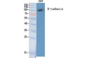 Western Blotting (WB) image for anti-Cadherin 1, Type 1, E-Cadherin (Epithelial) (CDH1) (C-Term) antibody (ABIN3180025) (E-cadherin antibody  (C-Term))
