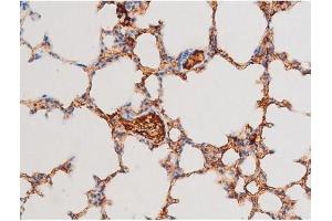 Immunohistochemistry (IHC) image for anti-GATA Binding Protein 4 (GATA4) (pSer105) antibody (ABIN6256094)