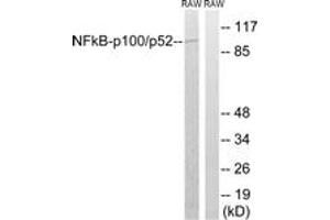 Western blot analysis of extracts from RAW264. (NFKB2 antibody  (AA 836-885))