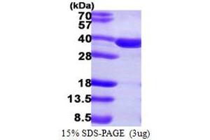 SDS-PAGE (SDS) image for Sulfotransferase Family, Cytosolic, 2A, Dehydroepiandrosterone (DHEA)-Preferring, Member 1 (SULT2A1) (AA 1-285) protein (His tag) (ABIN667467) (SULT2A1 Protein (AA 1-285) (His tag))