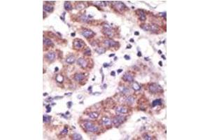 Image no. 2 for anti-Ubiquitin Specific Peptidase 3 (USP3) (N-Term) antibody (ABIN357523) (USP3 antibody  (N-Term))