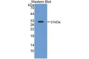 Western blot analysis of the recombinant protein. (PD-L1 antibody  (AA 34-241))