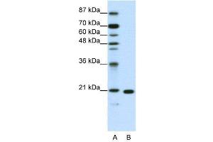 WB Suggested Anti-RPL9  Antibody Titration: 1. (RPL9 antibody  (C-Term))