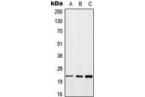 Western blot analysis of GADD45 beta expression in MCF7 (A), NIH3T3 (B), H9C2 (C) whole cell lysates. (GADD45B antibody  (C-Term))