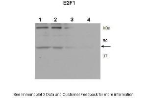 Lanes:  1. (E2F1 antibody  (Middle Region))