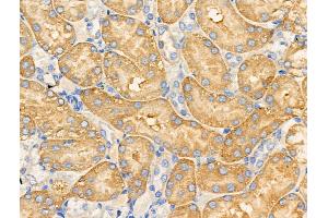ABIN6258515 and ABIN6274734 at 1/100 staining Rat kidney tissue by IHC-P.