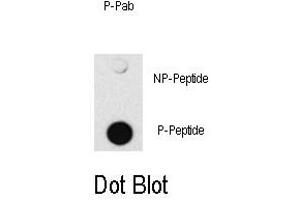 Image no. 1 for anti-SMAD Family Member 4 (SMAD4) (pThr277) antibody (ABIN358227) (SMAD4 antibody  (pThr277))