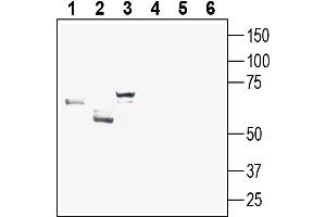 anti-Solute Carrier Family 2 (Facilitated Glucose Transporter) Member 8 (SLC2A8) (AA 342-355), (Extracellular) antibody
