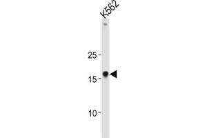Western Blotting (WB) image for anti-High Mobility Group AT-Hook 1 (HMGA1) antibody (ABIN3004034) (HMGA1 antibody)