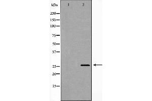 Western blot analysis of Hepg2 whole cell lysates, using RPS3 Antibody.