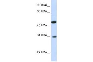 Western Blotting (WB) image for anti-Glycolipid Transfer Protein Domain Containing 2 (GLTPD2) antibody (ABIN2458880) (GLTPD2 antibody)