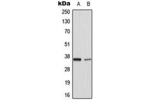 Western blot analysis of TNFAIP1 expression in HuvEC (A), rat lung (B) whole cell lysates. (TNFAIP1 antibody  (Center))
