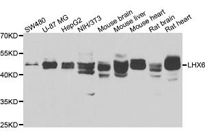 Western blot analysis of extracts of various cell lines, using LHX6 antibody (ABIN4904228) at 1:1000 dilution. (LHX6 antibody)