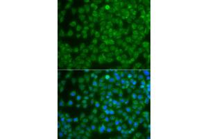 Immunofluorescence analysis of A549 cell using SPIB antibody. (SPIB antibody)