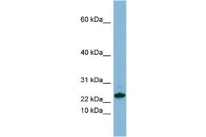 WB Suggested Anti-SPRR3 Antibody Titration:  0.