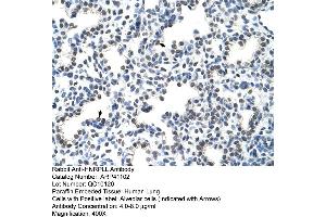 Rabbit Anti-HNRPLL Antibody  Paraffin Embedded Tissue: Human Lung Cellular Data: Alveolar cells Antibody Concentration: 4. (HNRPLL antibody  (N-Term))